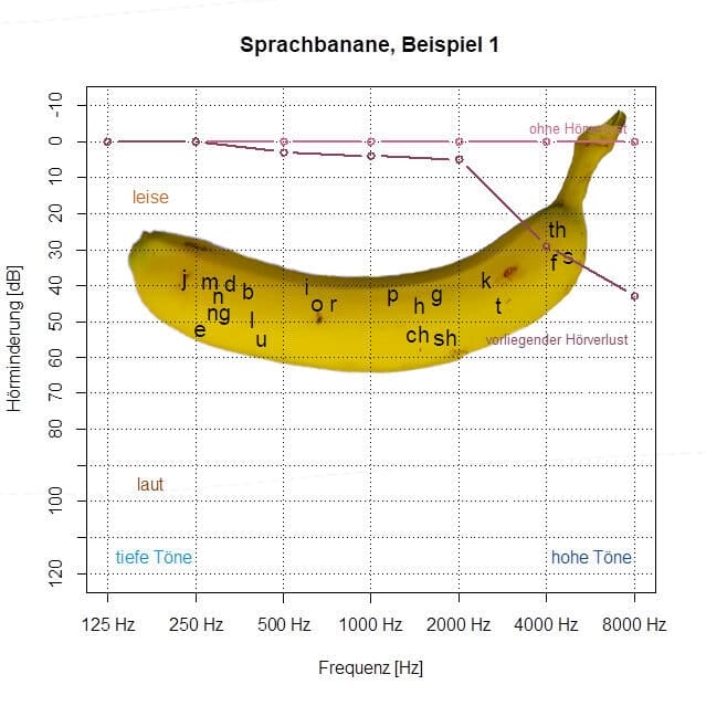 Audiogramm mit einer Bananenabbildung