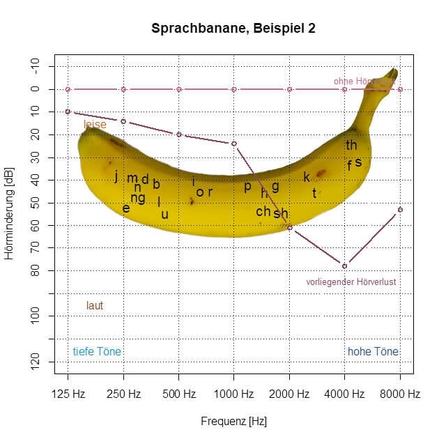 Audiogramm mit einer Bananenabbildung