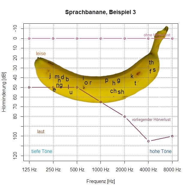 Audiogramme avec une image de banane
